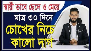 চোখের নিচে কালো দাগ দূর করবেন যেভাবে। বিশেষ রেমিডি। Physical care bangla Pro