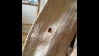 Really NASTY bedbug infestation in London treated by Environ Pest Control