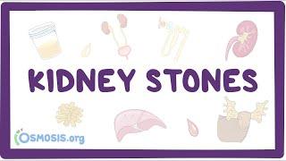Kidney stones (nephrolithiasis) - an Osmosis Preview