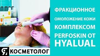Фракционное омоложение кожи комплексом PerfoSkin от Hyalual