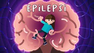 Bagaimana Epilepsi Bisa Terjadi?