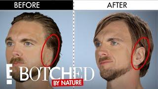 The Modern Day Van Gogh | Botched By Nature | E! Entertainment