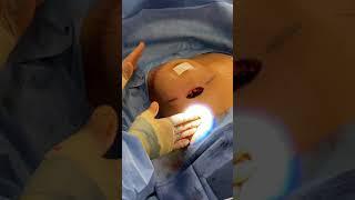 Rapid Recovery Breast Augmentation Surgery | Dr. David Stoker