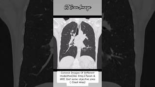 Xray , CT scan & MRI Coronal Image #radiology #trending #shorts #study #xray #ctscan #mri #yt