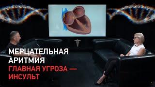 Мерцательная аритмия. Главная угроза - инсульт