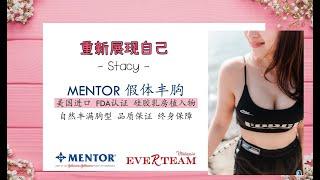 重新展现自己 - 我选择MENTOR乳房植入物隆胸