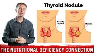What's Behind Thyroid Nodules? Thyroid Disorders & Selenium Deficiency – Dr.Berg