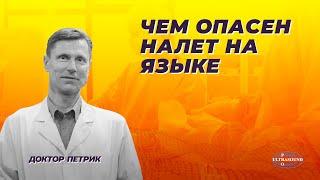 Чем опасен налет на языке.