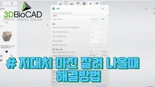 3Shape 스캔 과정중 지대치 마진이 잘려나올때 대처 방법