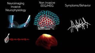 How multimodal research transforms neuroscience. -Prof. Dr. Med. Julian Neumann