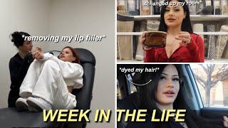 WEEK IN MY LIFE | dying my hair, redecorating my room, lip filler removed