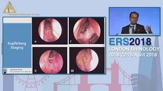 ERS London 2018, Allergic Fungal CRS- Update On Diagnosis And Medical Management,  Amin Javer