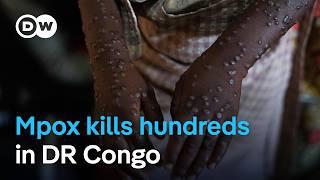 WHO warns mpox virus likely to spread | DW News