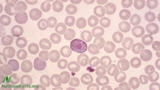 What Does a Low White Blood Cell Count Mean?