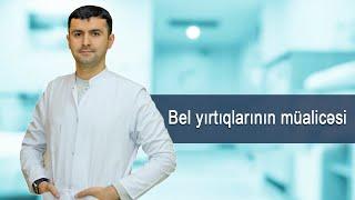 Bel yırtığının müalicəsi