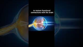 Stem cell therapy for restoring damaged optic nerve:  Integration into Neural Circuitry