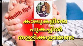 കാലുകളിലെ പുകച്ചിൽ തള്ളികളയേണ്ട.Health tips