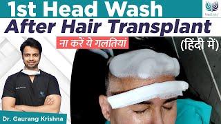 How to Wash Your Hair After Hair Transplant in Hindi? | MedLinks Hair Transplants Results