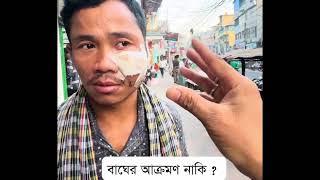 রাঙামাটিতে বাঘের আক্রমণের শিকার পাহাড়ি যুবক