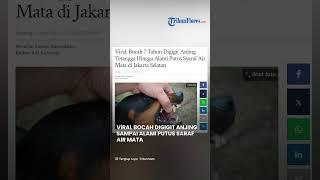 VIRAL Bocah Digigit Anjing Tetangga Alami Putus Saraf Air Mata, Pemilik Anjing Siap Tanggung Jawab