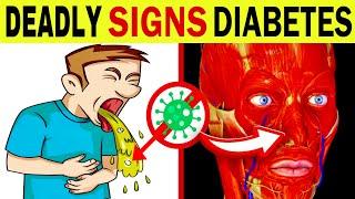 7 DEADLY SIGNS of DIABETES You Can't Ignore (Diabetic Ketoacidosis)