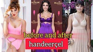 handeercel  #beforeandafter