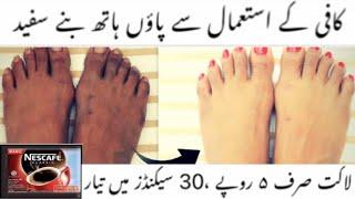 Totkay | Home Remedy For Dark Feet | How to Lighten Dark Feet | Way to Treat Dark Feet Naturally |