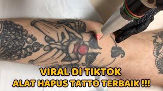 Alat Hapus Tatto Terbaik Viral DiTiktok
