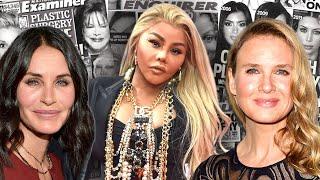 5 Celebrities Who "Ruined” Their Face with Plastic Surgery