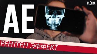 РЕНТГЕН ЭФФЕКТ/X-RAY SCANNER EFFECT Adobe After Effects