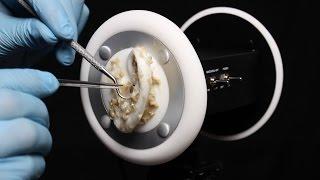 ASMR 3Dio Ear Peeling, Brushing Cleaning Latex Gloves - What Has Happened to Your Ears? (No talking)
