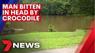 Man recovering after being bitten in the head by a crocodile | 7NEWS