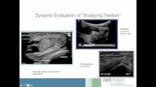 Advanced Diagnostic and Interventional Ultrasound Techniques for Tendinopathy Course Preview