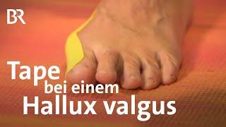 Was tun beim Ballenzeh? | Tape bei einem Hallux valgus | Anleitung | Fußpflege | Ballen