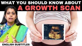 Growth Scan In Pregnancy | கரு வளர்ச்சி ஸ்கேன் பற்றி நீங்கள் தெரிந்து கொள்ள வேண்டிய விஷயங்கள்!