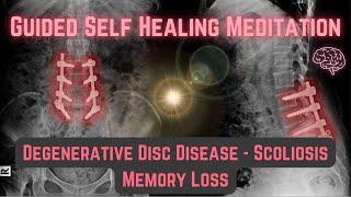 Healing Meditation for Degenerative Disc, scoliosis and memory