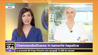 Tratamentul minim invaziv al tumorilor hepatice – Conf. Dr. Bogdan Popa | Spitalul Clinic SANADOR