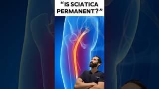 Is Sciatica Permanent or Is It Curable: Unraveling the Truth