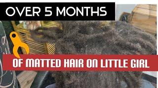 Detangling a child’s matted hair.