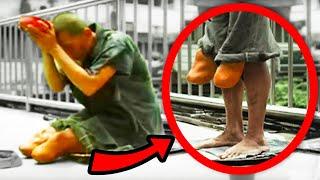 EXPOSING Fake Disabled Beggars