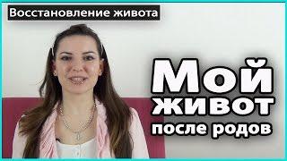 ️ МОЙ ЖИВОТ ПОСЛЕ РОДОВ | Растяжки, диастаз, пупочная грыжа, лишняя кожа  LilyBoiko