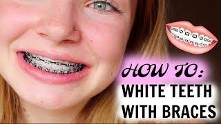 HOW I MAINTAIN WHITE TEETH WITH BRACES