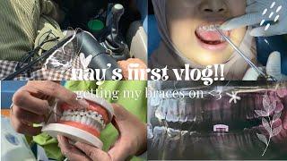 NAY’S FIRST VLOG ‪ getting my braces on & unbox new case ʚ ɞ