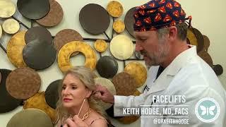 Dr. Keith Hodge - Facelifts & Monarch Mini Facelifts