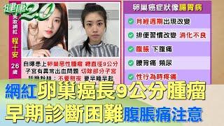 千萬網紅25歲卵巢癌長9公分腫瘤 警世不要熬夜 健康2.0