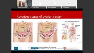 3/26/2021: Upfront Treatment of Advanced Ovarian Cancer; Ay, Now the Plot Thickens