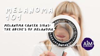 Melanoma Cancer Signs: The ABCDEs of Melanoma