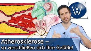 Verstopfte Gefäße: Warum Atherosklerose total unterschätzt wird, wir aber viel dagegen tun können!