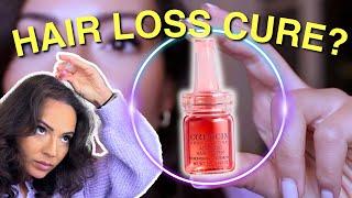 The NEW cure for Hair Loss?! (The Hair Growth Power of Stem Cells with Calecim)