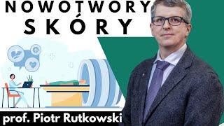 Nowotwory skóry: rak kolczystokomórkowy i czerniak